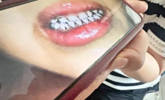 ngộ độc thực phẩm, trường mầm non, trẻ nhỏ bị ngộ độc