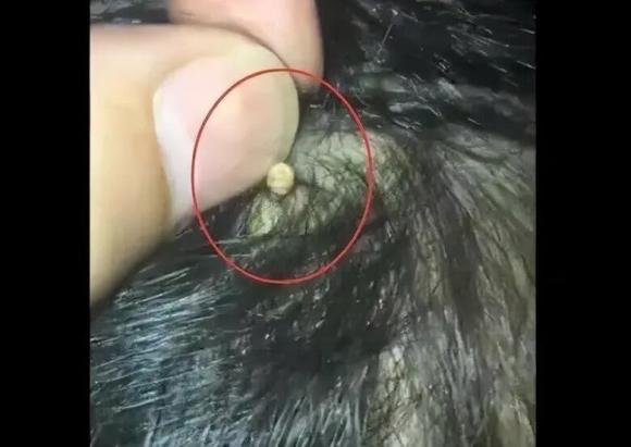 chăm con, trẻ bị bọ tấn công, sức khỏe