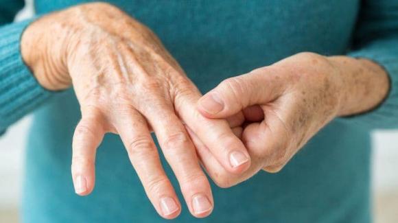 sức khỏe, nhồi máu não, đột quỵ, 