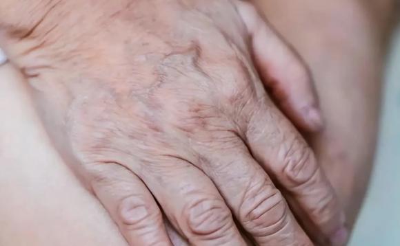 gân xanh, gân xanh là dấu hiệu bệnh gì