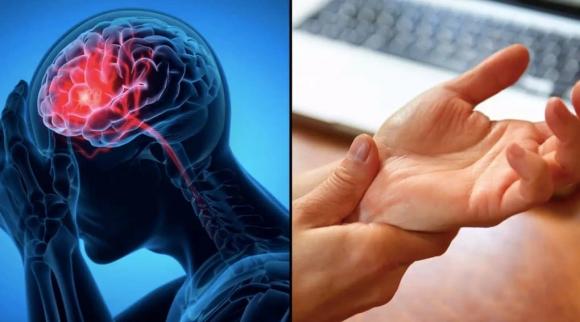 dấu hiệu đột quỵ trước một tuần, 
