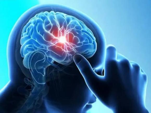 đột quỵ, dấu hiệu đột quỵ, cách sơ cứu người đột quỵ