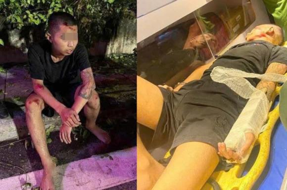 cảnh sát cơ động, đâm cảnh sát cơ động, kiến thức