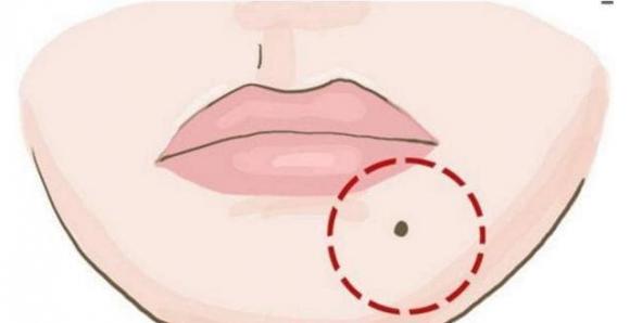 nốt ruồi phú quý, nốt ruồi tài lộc, nốt ruồi may mắn