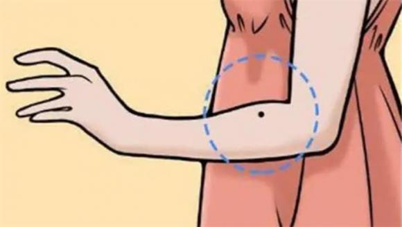 nốt ruồi phú quý, nốt ruồi tài lộc, nốt ruồi may mắn