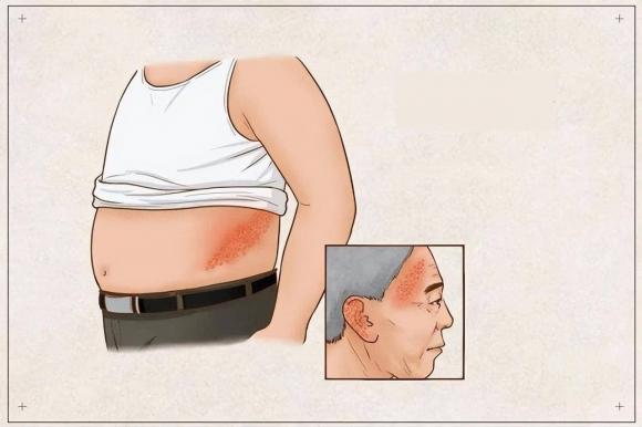 sức khỏe, đau đớn do bệnh, bệnh gây đau đớn, căn bệnh được xem là đau đớn nhất thế giới, bệnh đau nhất thế giới
