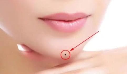 nốt ruồi, vị trí nốt ruồi may mắn