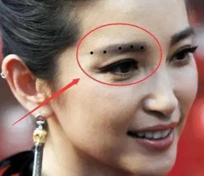 nốt ruồi, vị trí nốt ruồi may mắn