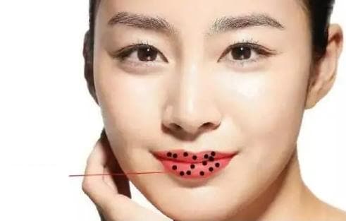 nốt ruồi, vị trí nốt ruồi may mắn