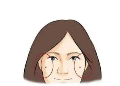 nốt ruồi, vị trí nốt ruồi may mắn