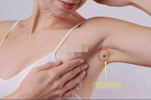 nốt ruồi, nốt ruồi may mắn