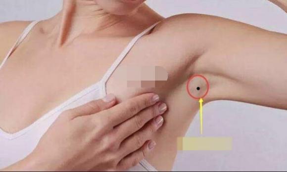 nốt ruồi, tướng mặt, nốt ruồi tốt