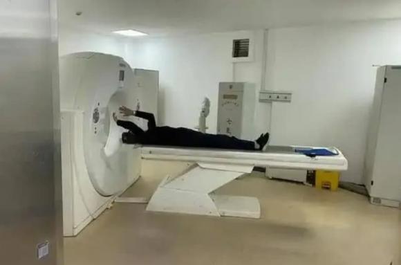 nhồi máu não, dấu hiệu nhồi máu não