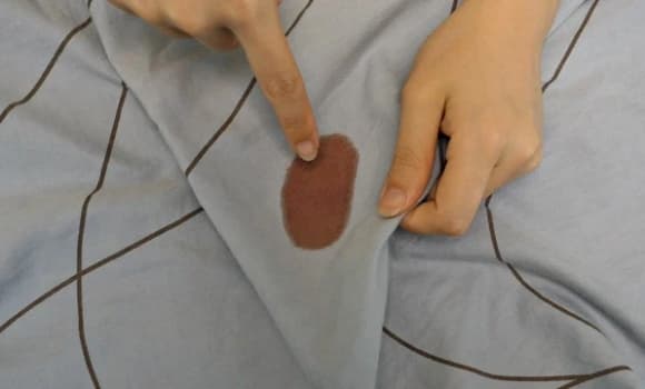 chảy máu, ung thư, chảy máu cam, dấu hiệu ung thư