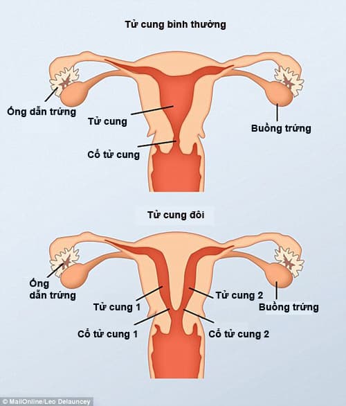 Người phụ nữ có 2 âm đạo, chuyện lạ thế giới