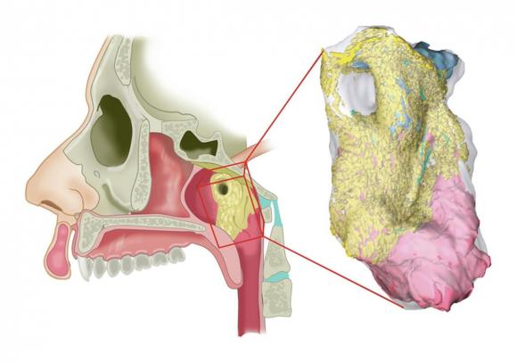 Phát hiện cơ quan mới ở người, bệnh ung thư, kiến thức