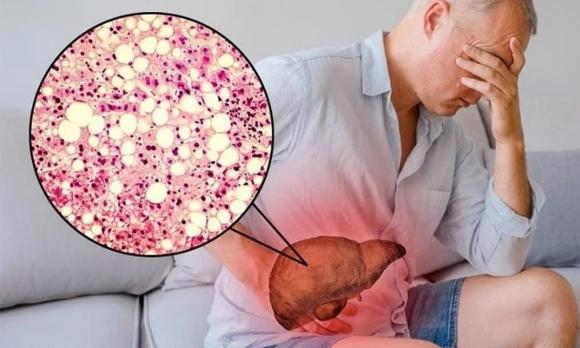 ung thư, viêm nhiễm, từ viêm nhiễm đến ung thư, viêm nhiễm nguy hiểm nhất