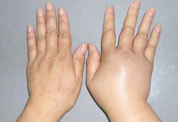 thận yếu, dấu hiệu thận yếu, ban đêm
