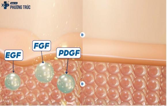 m3-ngoisaovn-w1085-h692 2 Làm đầy tự thân Maxfill Nano, Bác sĩ Phương Trúc, Trẻ hóa không xâm lấn