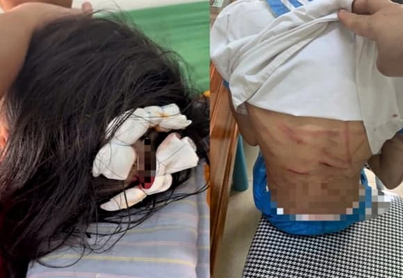 06-cha-duong-dung-bua-bao-hanh-con-rieng-o-ha-tinh-1.jpg 1 Cha dượng bạo hành con riêng ở Hà Tĩnh, bạo hành con riêng