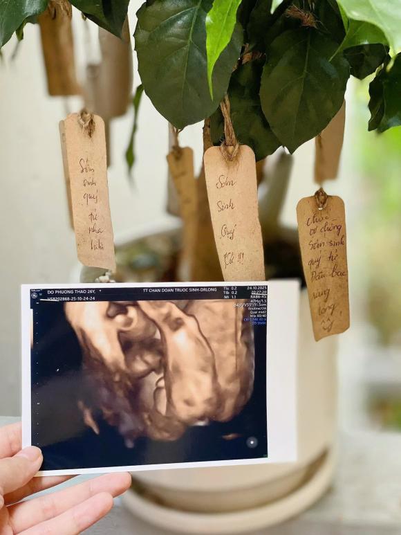 Diễn viên Hoàng Triều Dương - con trai NSND Hoàng Dũng báo tin vui có con sau 7 tháng kết hôn với vợ đã yêu 9 năm (9).jpg 0 hoàng triều dương, nsnd hoàng dũng, sao việt