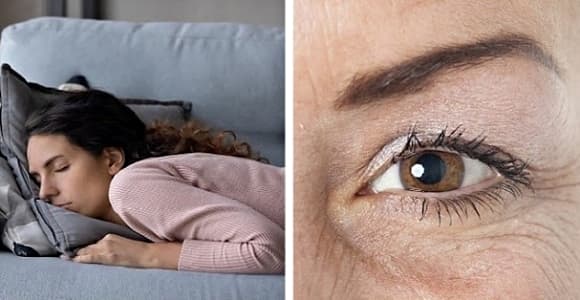 Tư thế ngủ, nếp nhăn