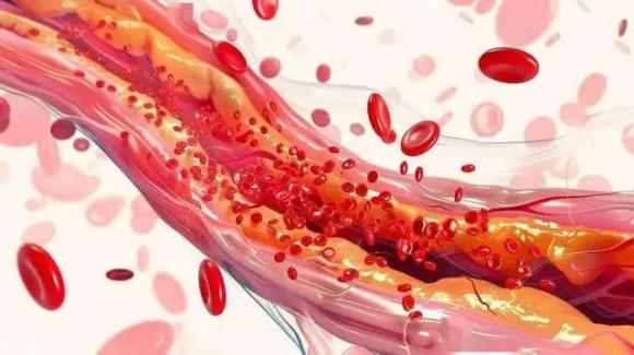 banh-ngot (1).jpg 4 cholesterol cao