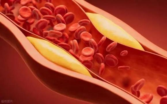 banh-ngot (1).jpg 6 cholesterol cao