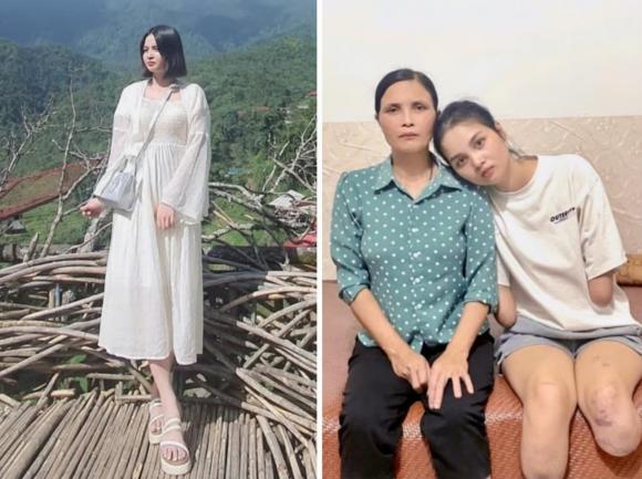 nga tích cực 1 Cô gái mất tứ chi, AI lừa đảo, giới trẻ