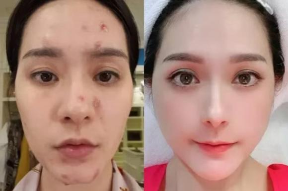 nhan-sac-cua-doan-di-bang-truoc-khi-chi-hang-chuc-ty-22vit-hoa-thien-nga22-4-ngoisaovn-w1264-h840 1 Đoàn Di Băng, sao Việt