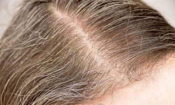 toc-bac (1).jpg 3 tóc bạc