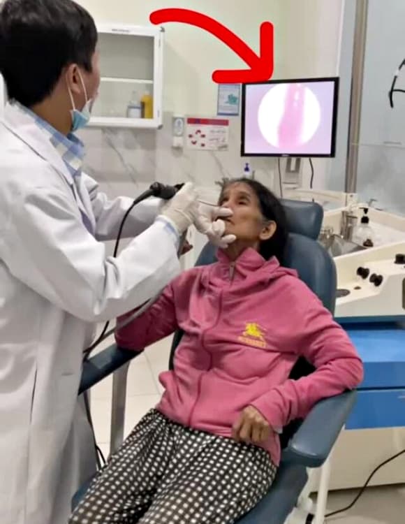 con đỉa, con đỉa trong mũi, Đà Nẵng, chảy máu cam