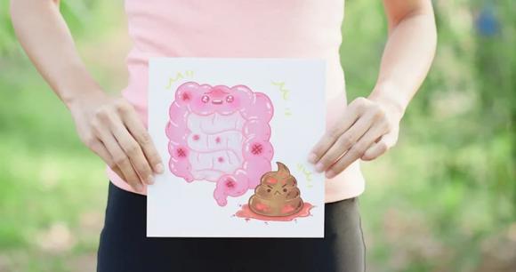 bệnh trĩ, ung thu đại trực tràng