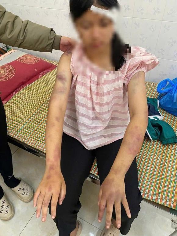 bé gái 14 tuổi, bé gái 14 tuổi bị bà nội bạo hành 