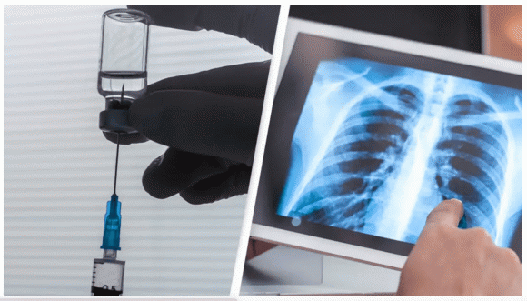 ung thư phổi, thuốc chữa ung thư phổi, sức khỏe