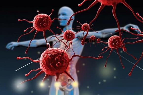 ung thư, điều trị ung thư, sức khỏe