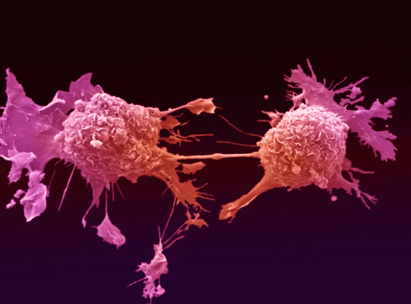 ung thư phổi, thuốc chữa ung thư phổi, sức khỏe