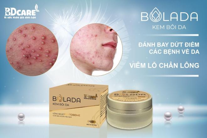 Bolada, kem bôi da Bolada, kem bôi da