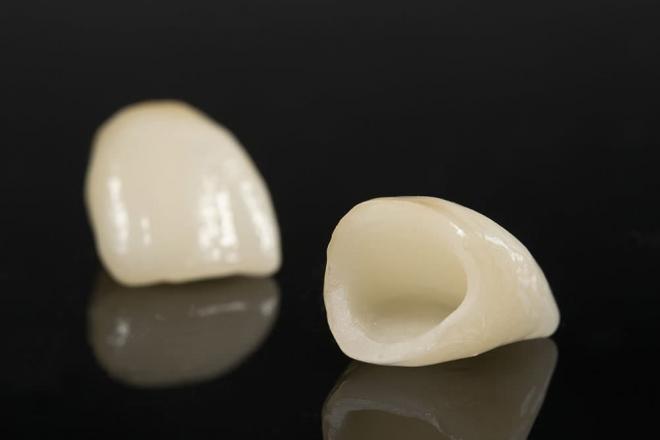 nha khoa Implant Quốc tế, nha khoa Đà Nẵng, răng sứ thẩm mỹ
