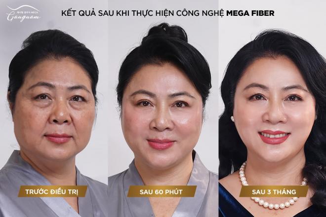 Mega Gangnam, trẻ hóa tự thân từ A.I 