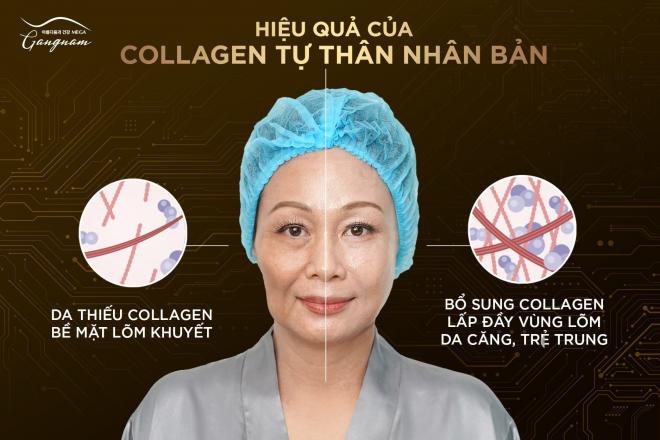 Mega Gangnam, trẻ hóa tự thân từ A.I 
