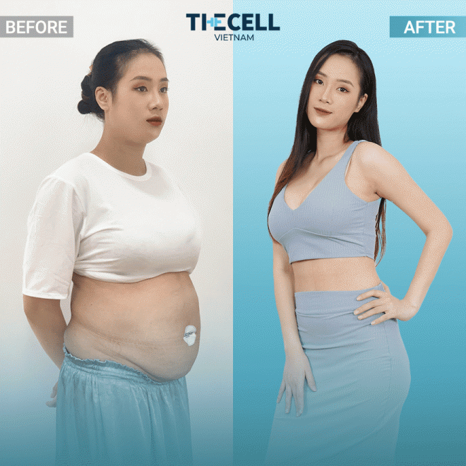 The Cell Việt Nam, Phòng khám thẩm mỹ, trẻ hóa da, xu hướng làm đẹp