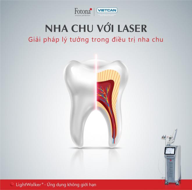 Điều trị viêm nha chu hiệu quả, LightWalker, chăm sóc răng miệng