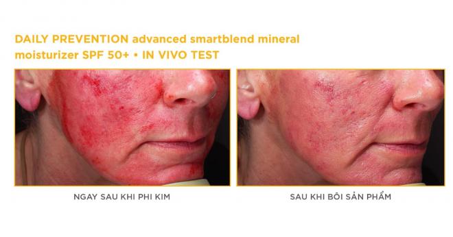 Exosome Imageskincare, Daily Prevention