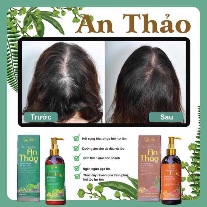 An Thảo, Dầu gội đầu An Thảo, Bộ gội xả An Thảo